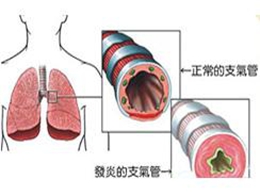 支氣管哮喘典型的臨床癥狀是,支氣管哮喘的典型臨床癥狀與實地考察數(shù)據(jù)策略在游戲版的應(yīng)用,未來解答解析說明_投資版54.80.74